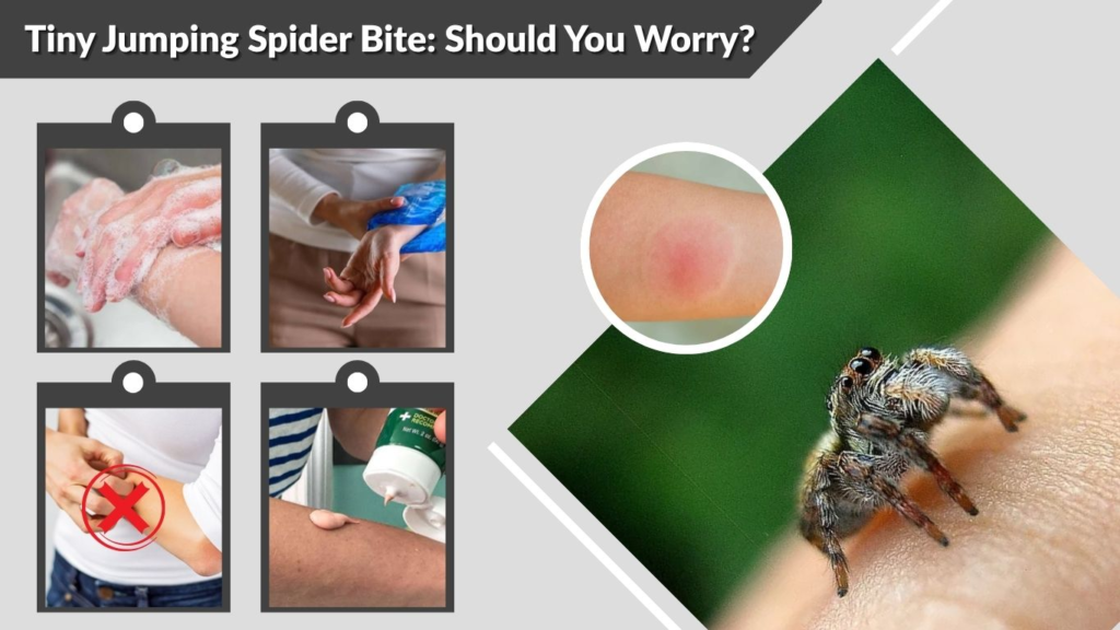 Tiny Jumping Spider Bite: Should You Worry?