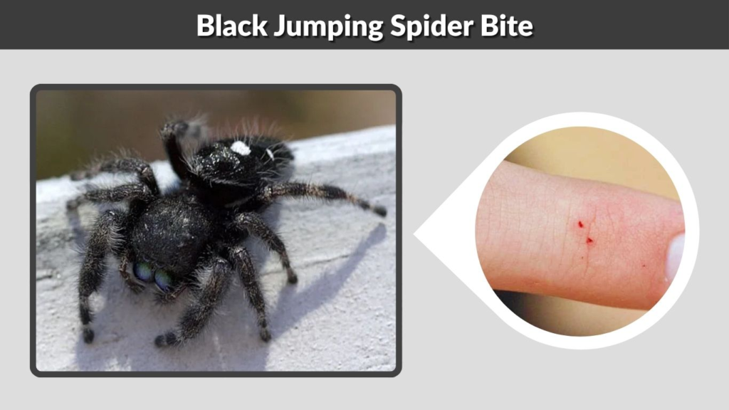 Black Jumping Spider Bite