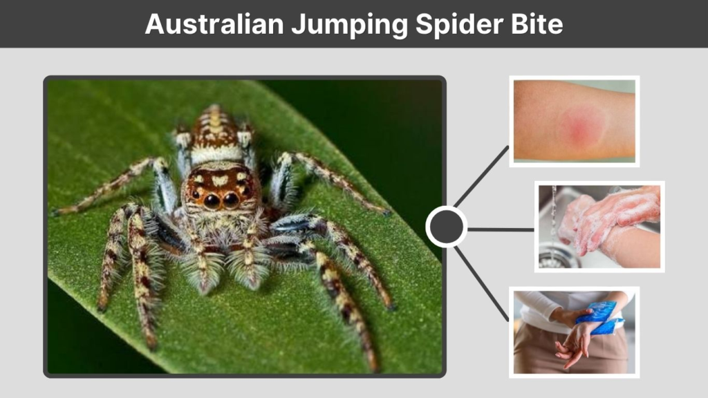 Australian Jumping Spider Bite