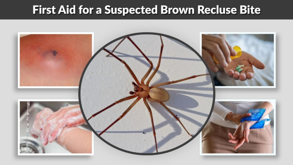 First Aid for a Suspected Brown Recluse Bite