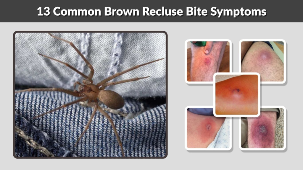 13 Common Brown Recluse Bite Symptoms