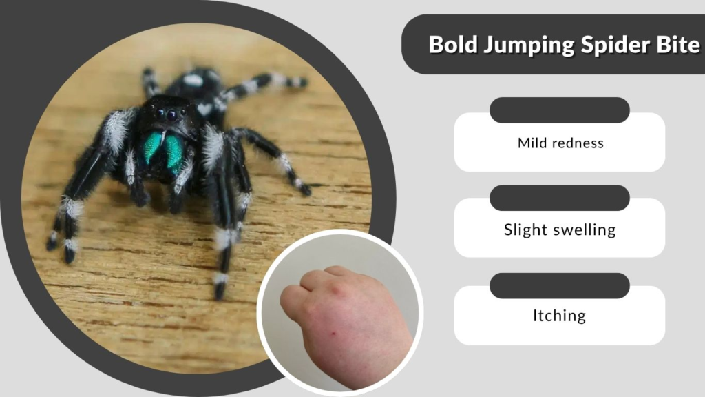 Bold Jumping Spider Bite