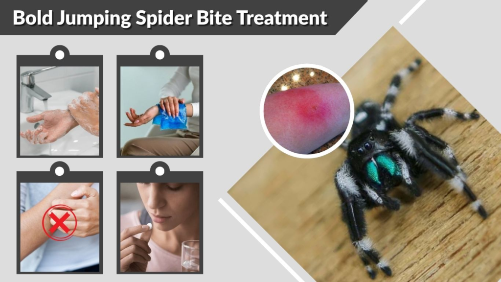 Bold Jumping Spider Bite Treatment