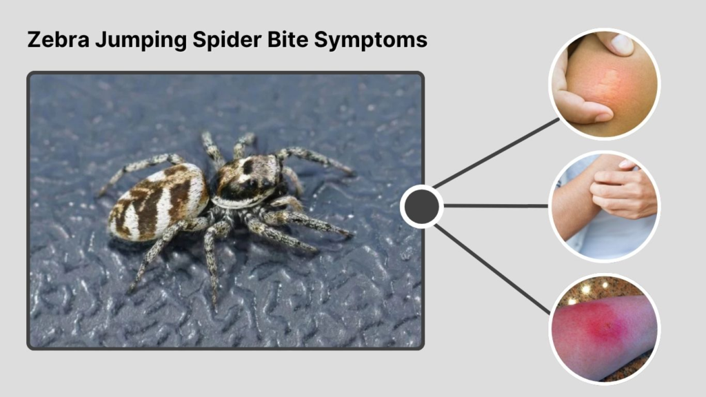 Zebra Jumping Spider Bite Symptoms