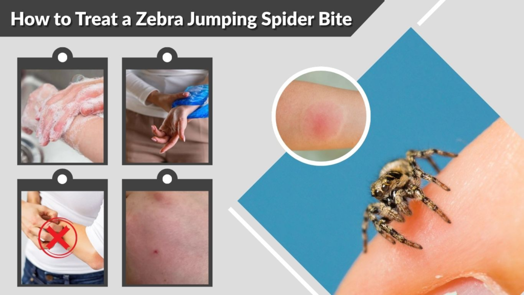 How to Treat a Zebra Jumping Spider Bite