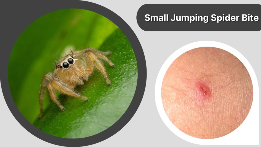 Small Jumping Spider Bite