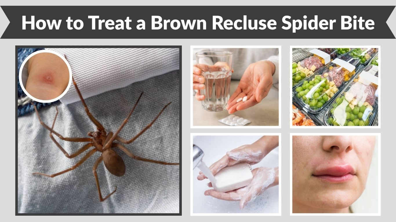 How to Treat a Brown Recluse Spider Bite: Step-by-Step Guide