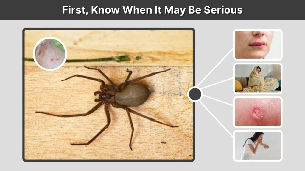 First, Know When It May Be Serious