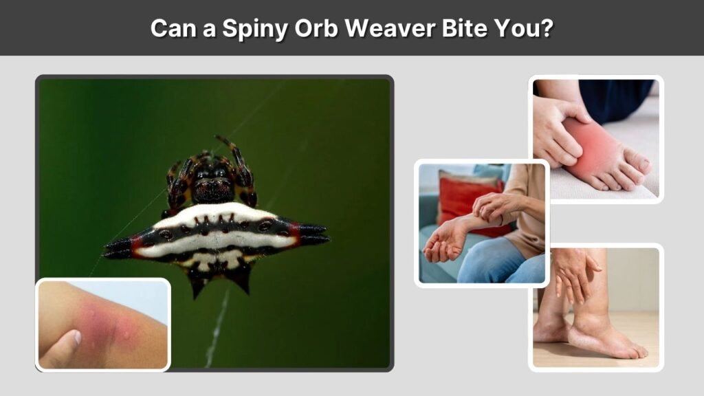 Can a Spiny Orb Weaver Bite You?