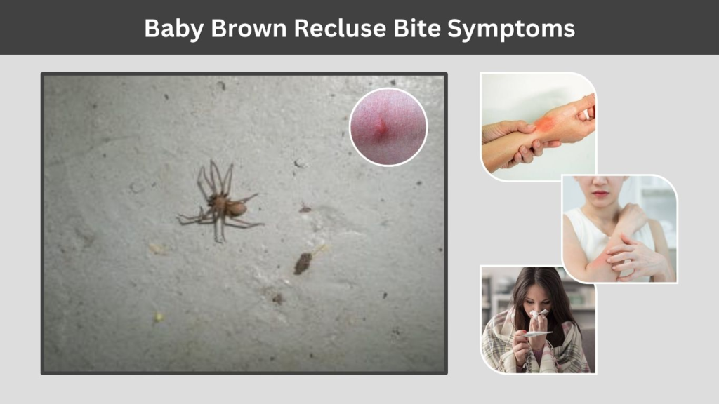 Baby Brown Recluse Bite Symptoms