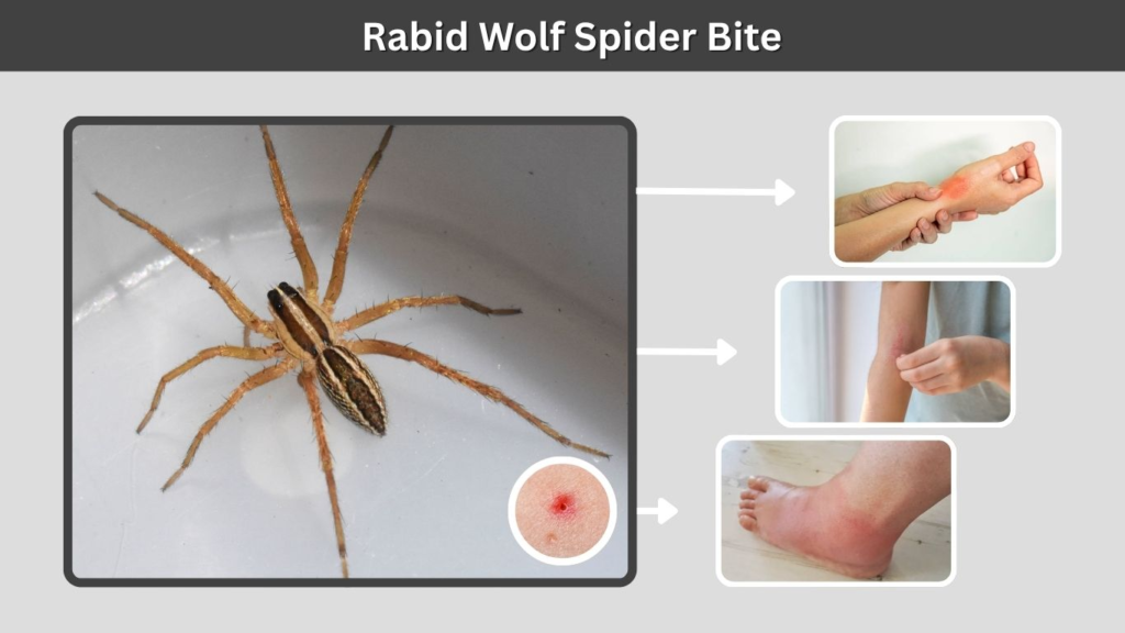 Rabid Wolf Spider Bite