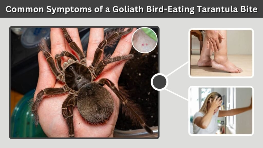 Common Symptoms of a Goliath Bird-Eating Tarantula Bite