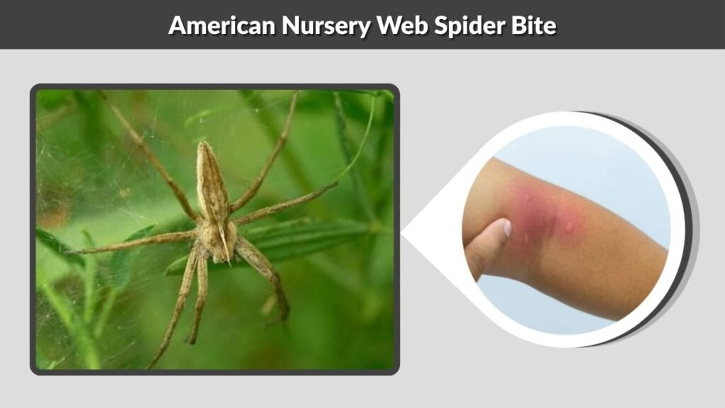 American Nursery Web Spider Bite