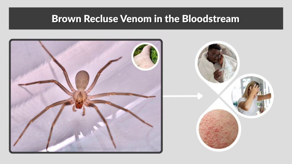 Brown Recluse Venom in the Bloodstream
