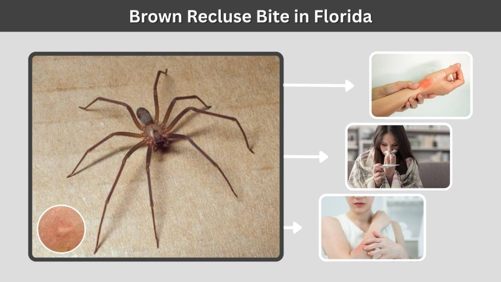Brown Recluse Bite in Florida