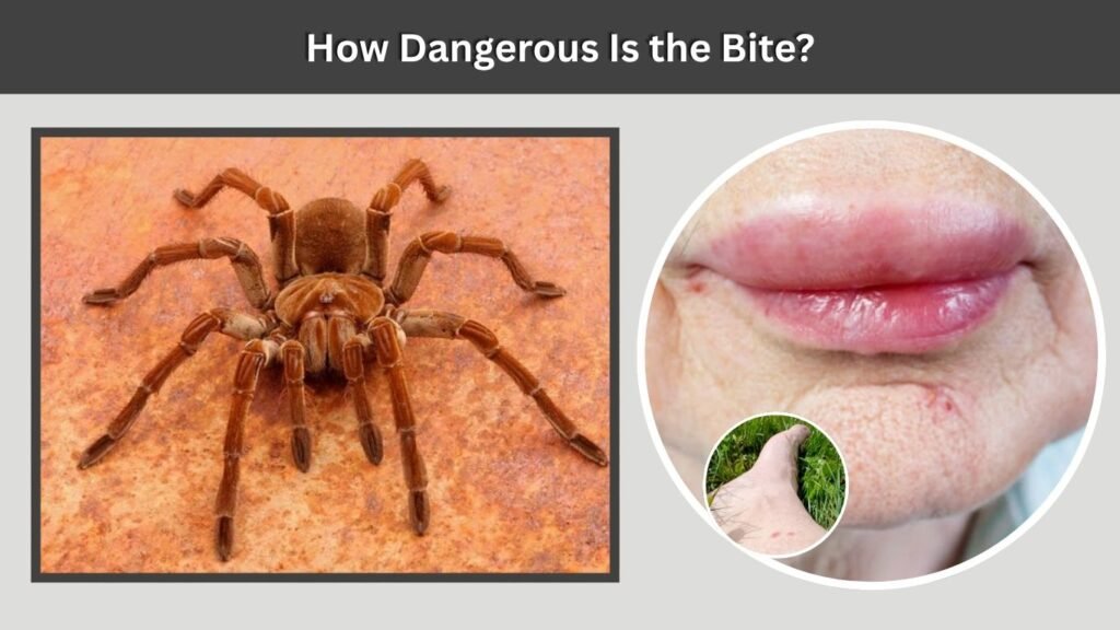 How Dangerous Is the Bite?