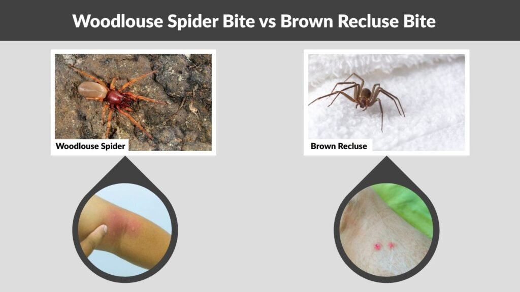 Woodlouse Spider Bite vs Brown Recluse Bite