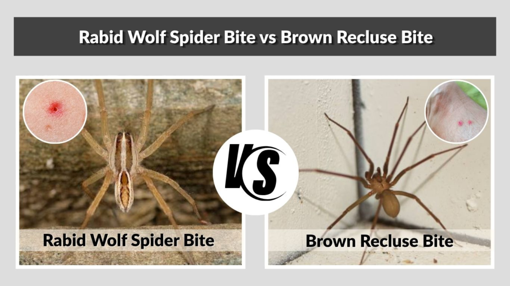 Rabid Wolf Spider Bite vs Brown Recluse Bite