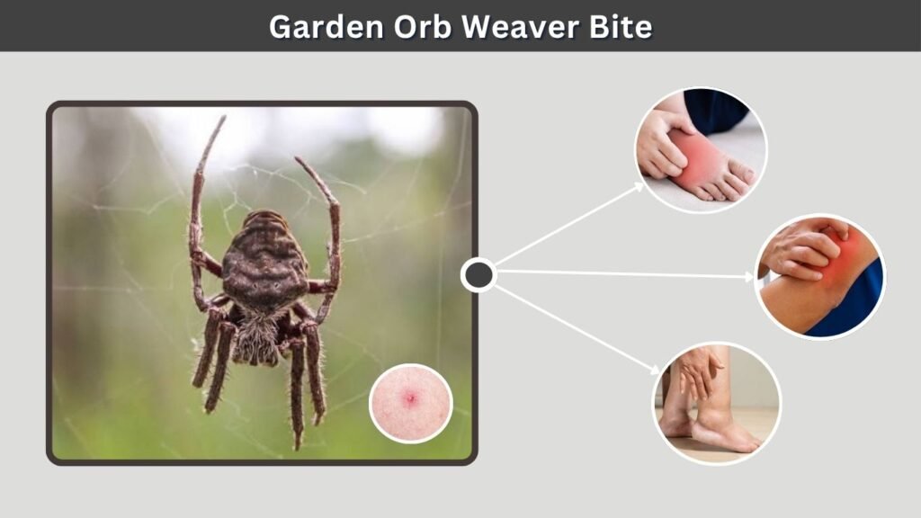 Garden Orb Weaver Bite