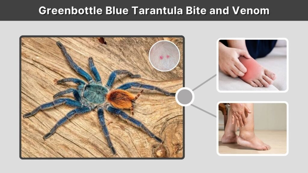 Greenbottle Blue Tarantula Bite and Venom