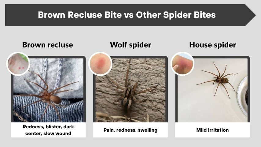Brown Recluse Bite vs Other Spider Bites