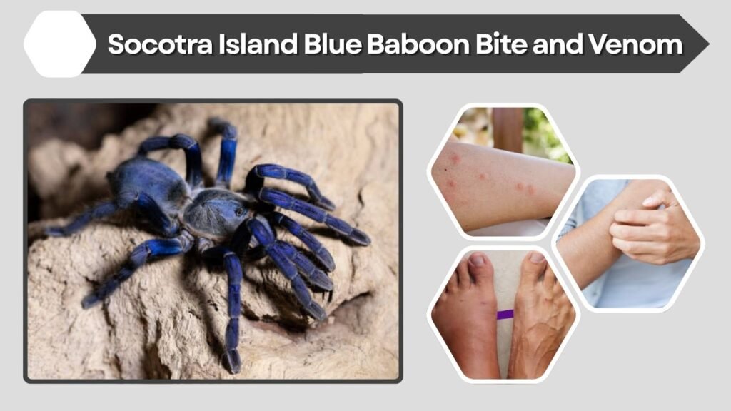 Socotra Island Blue Baboon Bite and Venom