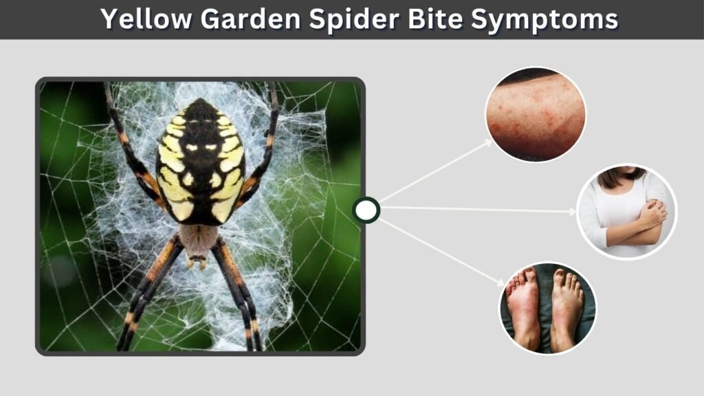 Yellow Garden Spider Bite Symptoms