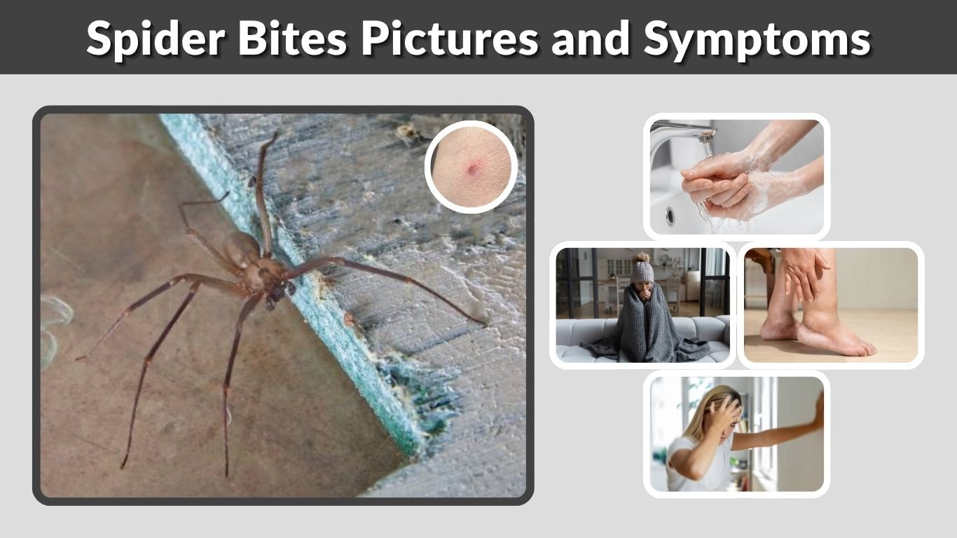 Spider Bites Pictures and Symptoms: Identification Guide