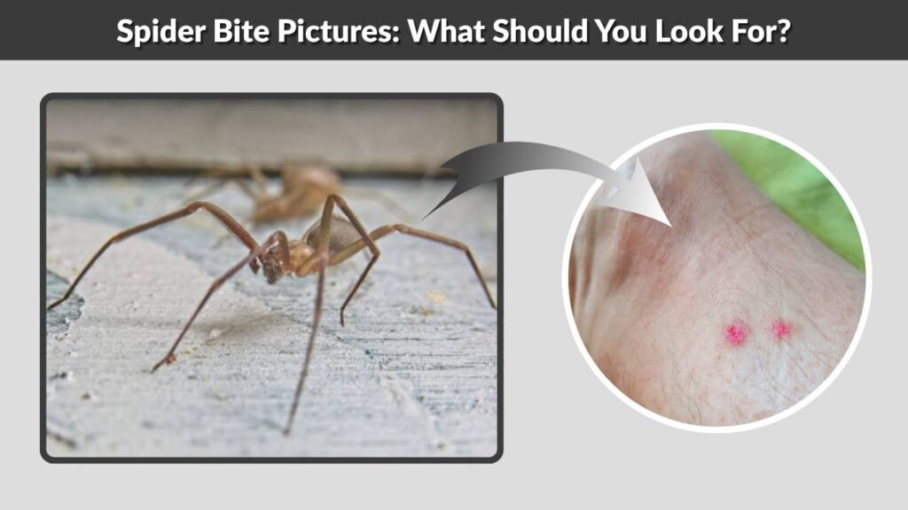 Spider Bite Pictures: What Should You Look For?