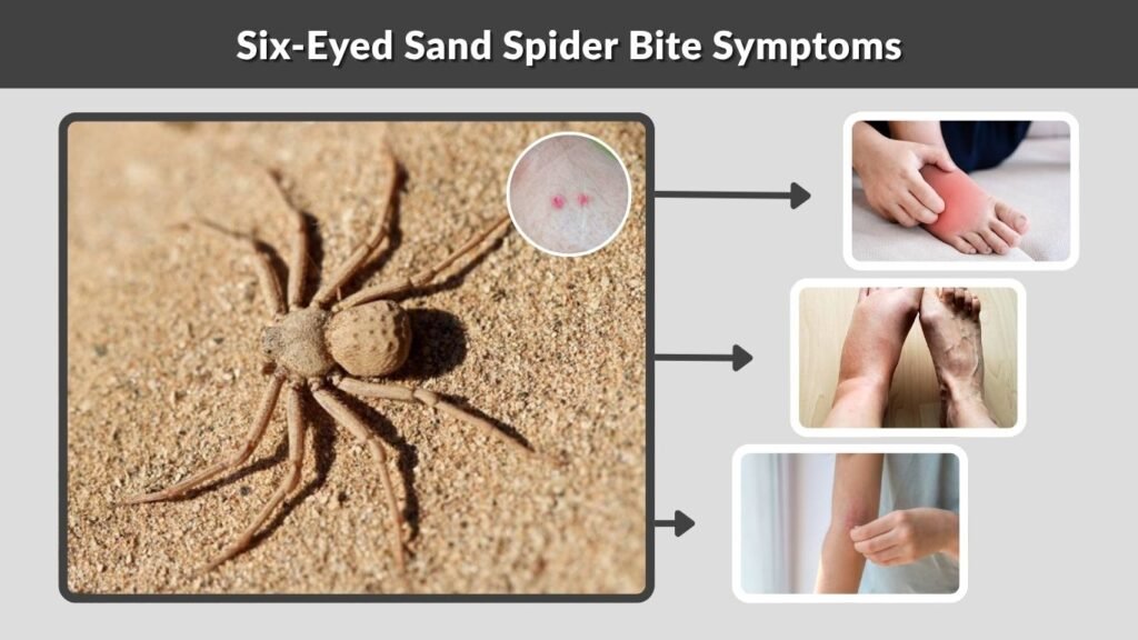 Six-Eyed Sand Spider Bite Symptoms