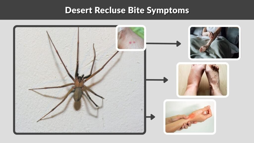 Desert Recluse Bite Symptoms