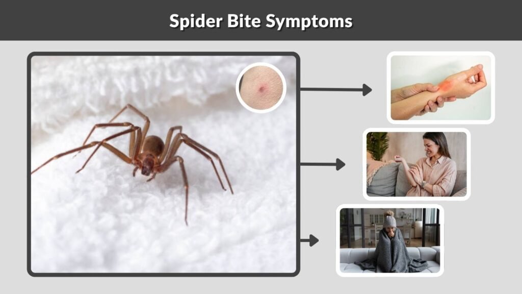 Spider Bite Symptoms
