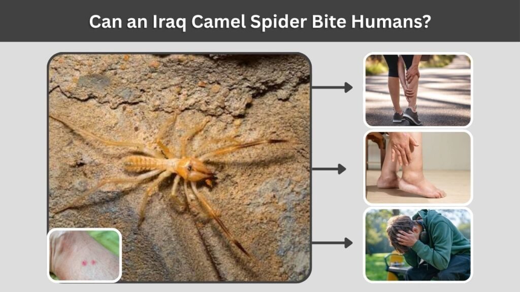 Can an Iraq Camel Spider Bite Humans?