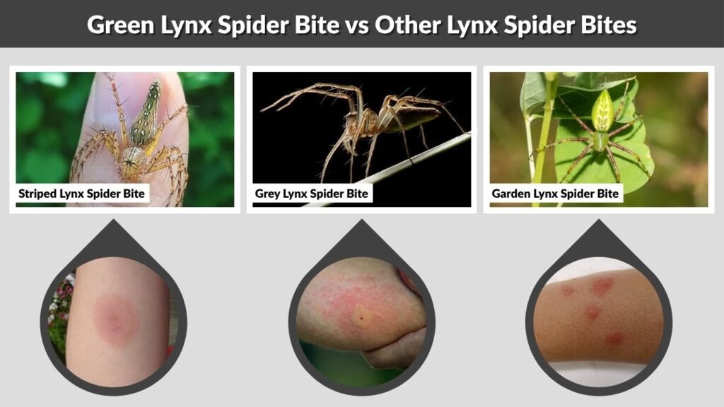 Green Lynx Spider Bite vs Other Lynx Spider Bites