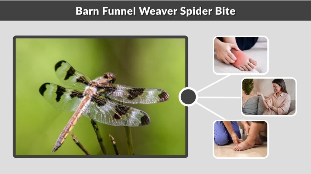 Barn Funnel Weaver Spider Bite