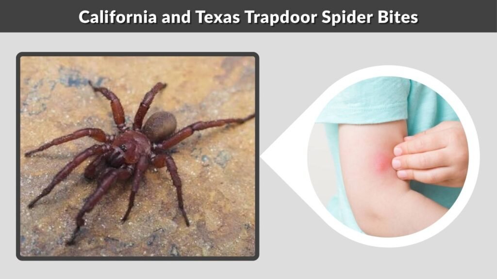 California and Texas Trapdoor Spider Bites
