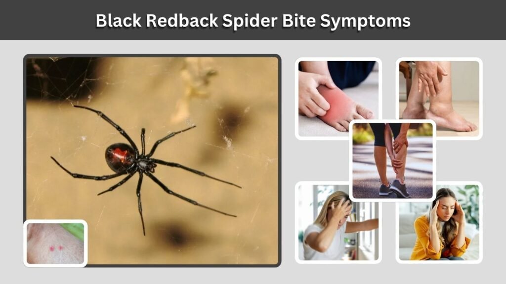 Black Redback Spider Bite Symptoms