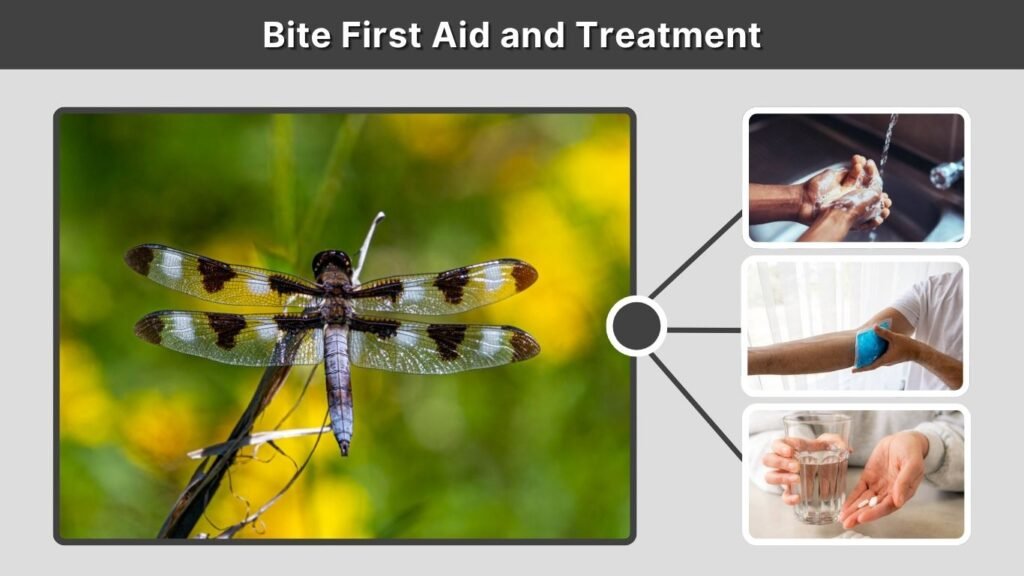 Bite First Aid and Treatment