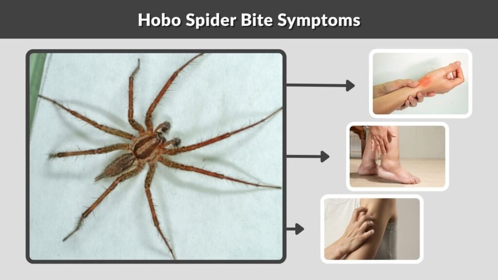 Hobo Spider Bite Symptoms