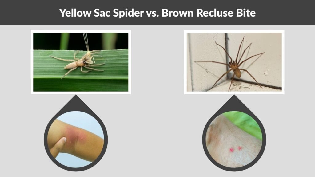 Yellow Sac Spider vs. Brown Recluse Bite